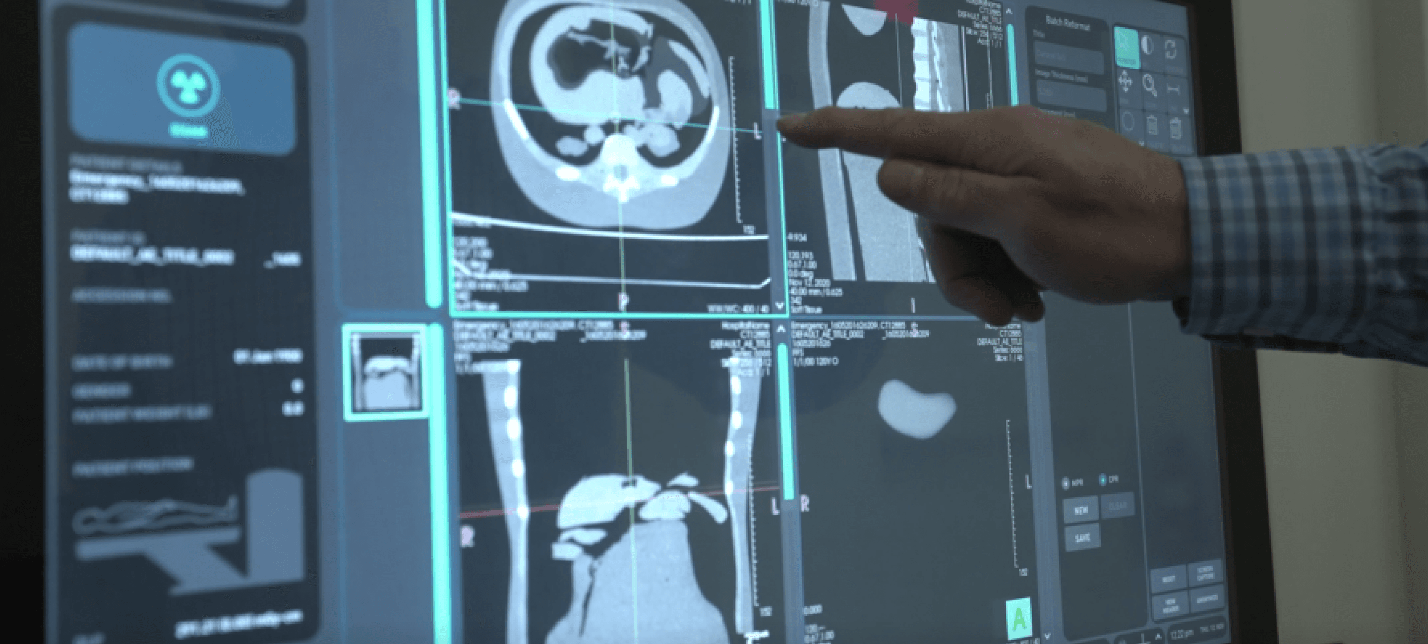 Image of xray on screen